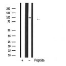 Western blot analysis of extracts from Rat brain, using DNMT3B Antibody. The lane on the left was treated with blocking peptide.