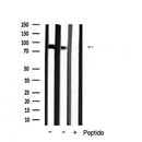 Western blot analysis of extracts from 293t, using Catenin gamma Antibody. The lane on the left was treated with blocking peptide.