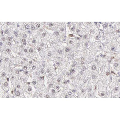 AF0122 at 1/200 staining human liver carcinoma tissue sections by IHC-P. The tissue was formaldehyde fixed and a heat mediated antigen retrieval step in citrate buffer was performed. The tissue was then blocked and incubated with the antibody for 1.5 hours at 22¡ãC. An HRP conjugated goat anti-rabbit antibody was used as the secondary