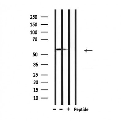 Western blot analysis of extracts from mouse brain and HepG2, using Caspase 10 Antibody.
