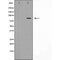 DF6001 at 1/100 staining Mouse brain tissue by IHC-P. The sample was formaldehyde fixed and a heat mediated antigen retrieval step in citrate buffer was performed. The sample was then blocked and incubated with the antibody for 1.5 hours at 22¡ãC. An HRP conjugated goat anti-rabbit antibody was used as the secondary