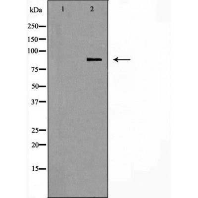 DF6002 at 1/100 staining Rat lung tissue by IHC-P. The sample was formaldehyde fixed and a heat mediated antigen retrieval step in citrate buffer was performed. The sample was then blocked and incubated with the antibody for 1.5 hours at 22¡ãC. An HRP conjugated goat anti-rabbit antibody was used as the secondary