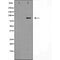 DF6002 at 1/100 staining Rat lung tissue by IHC-P. The sample was formaldehyde fixed and a heat mediated antigen retrieval step in citrate buffer was performed. The sample was then blocked and incubated with the antibody for 1.5 hours at 22¡ãC. An HRP conjugated goat anti-rabbit antibody was used as the secondary