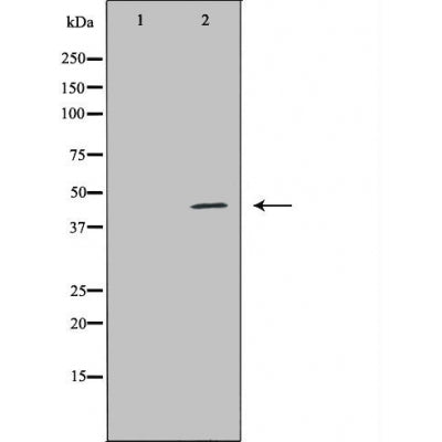 DF6005 at 1/100 staining Mouse liver tissue by IHC-P. The sample was formaldehyde fixed and a heat mediated antigen retrieval step in citrate buffer was performed. The sample was then blocked and incubated with the antibody for 1.5 hours at 22¡ãC. An HRP conjugated goat anti-rabbit antibody was used as the secondary