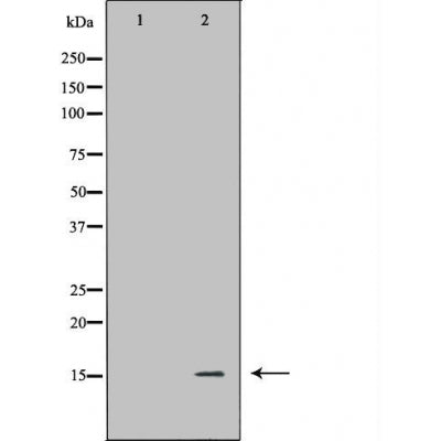 DF6006 at 1/100 staining Mouse kidney tissue by IHC-P. The sample was formaldehyde fixed and a heat mediated antigen retrieval step in citrate buffer was performed. The sample was then blocked and incubated with the antibody for 1.5 hours at 22¡ãC. An HRP conjugated goat anti-rabbit antibody was used as the secondary