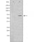 DF6007 staining Hepg2 by IF/ICC. The sample were fixed with PFA and permeabilized in 0.1% Triton X-100,then blocked in 10% serum for 45 minutes at 25¡ãC. The primary antibody was diluted at 1/200 and incubated with the sample for 1 hour at 37¡ãC. An  Alexa Fluor 594 conjugated goat anti-rabbit IgG (H+L) Ab, diluted at 1/600, was used as the secondary antibod