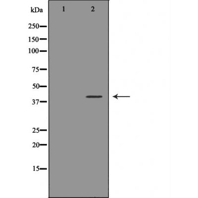 DF6008 at 1/100 staining Rat lung tissue by IHC-P. The sample was formaldehyde fixed and a heat mediated antigen retrieval step in citrate buffer was performed. The sample was then blocked and incubated with the antibody for 1.5 hours at 22¡ãC. An HRP conjugated goat anti-rabbit antibody was used as the secondary