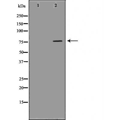 DF6009 at 1/100 staining Mouse lung tissue by IHC-P. The sample was formaldehyde fixed and a heat mediated antigen retrieval step in citrate buffer was performed. The sample was then blocked and incubated with the antibody for 1.5 hours at 22¡ãC. An HRP conjugated goat anti-rabbit antibody was used as the secondary