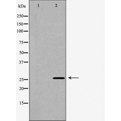 DF6015 at 1/100 staining Human gastric tissue by IHC-P. The sample was formaldehyde fixed and a heat mediated antigen retrieval step in citrate buffer was performed. The sample was then blocked and incubated with the antibody for 1.5 hours at 22¡ãC. An HRP conjugated goat anti-rabbit antibody was used as the secondary