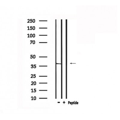 DF6017 at 1/100 staining Mouse brain tissue by IHC-P. The sample was formaldehyde fixed and a heat mediated antigen retrieval step in citrate buffer was performed. The sample was then blocked and incubated with the antibody for 1.5 hours at 22¡ãC. An HRP conjugated goat anti-rabbit antibody was used as the secondary