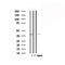DF6017 at 1/100 staining Mouse brain tissue by IHC-P. The sample was formaldehyde fixed and a heat mediated antigen retrieval step in citrate buffer was performed. The sample was then blocked and incubated with the antibody for 1.5 hours at 22¡ãC. An HRP conjugated goat anti-rabbit antibody was used as the secondary