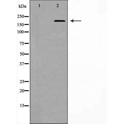 Western blot analysis of Hela whole cell lysates, using BRCA1 Antibody. The lane on the left is treated with the antigen-specific peptide.