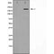 Western blot analysis of Hela whole cell lysates, using BRCA1 Antibody. The lane on the left is treated with the antigen-specific peptide.