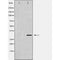 DF6022 staining COLO205 by IF/ICC. The sample were fixed with PFA and permeabilized in 0.1% Triton X-100,then blocked in 10% serum for 45 minutes at 25¡ãC. The primary antibody was diluted at 1/200 and incubated with the sample for 1 hour at 37¡ãC. An  Alexa Fluor 594 conjugated goat anti-rabbit IgG (H+L) Ab, diluted at 1/600, was used as the secondary antibod
