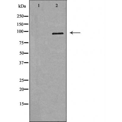 Western blot analysis of extracts of SW620, using CD133 antibody. The lane on the left is treated with the antigen-specific peptide.