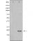 DF6025 at 1/100 staining Human lung tissue by IHC-P. The sample was formaldehyde fixed and a heat mediated antigen retrieval step in citrate buffer was performed. The sample was then blocked and incubated with the antibody for 1.5 hours at 22¡ãC. An HRP conjugated goat anti-rabbit antibody was used as the secondary