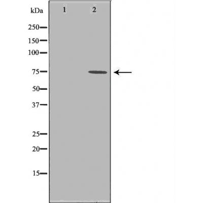 DF6026 staining  Hela cells by IF/ICC. The sample were fixed with PFA and permeabilized in 0.1% Triton X-100,then blocked in 10% serum for 45 minutes at 25¡ãC. The primary antibody was diluted at 1/200 and incubated with the sample for 1 hour at 37¡ãC. An  Alexa Fluor 594 conjugated goat anti-rabbit IgG (H+L) antibody(Cat.# S0006), diluted at 1/600, was used as secondary antibod