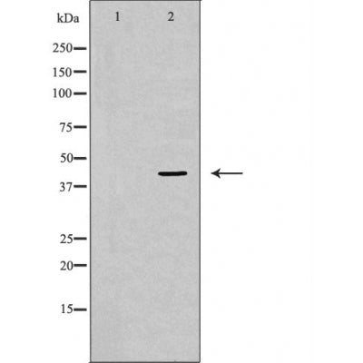 DF6032 at 1/100 staining Human kidney tissue by IHC-P. The sample was formaldehyde fixed and a heat mediated antigen retrieval step in citrate buffer was performed. The sample was then blocked and incubated with the antibody for 1.5 hours at 22¡ãC. An HRP conjugated goat anti-rabbit antibody was used as the secondary