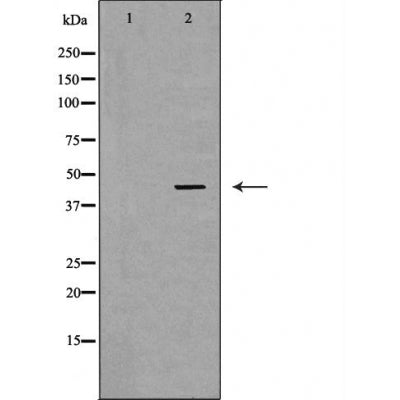 DF6034 at 1/100 staining Mouse liver tissue by IHC-P. The sample was formaldehyde fixed and a heat mediated antigen retrieval step in citrate buffer was performed. The sample was then blocked and incubated with the antibody for 1.5 hours at 22¡ãC. An HRP conjugated goat anti-rabbit antibody was used as the secondary