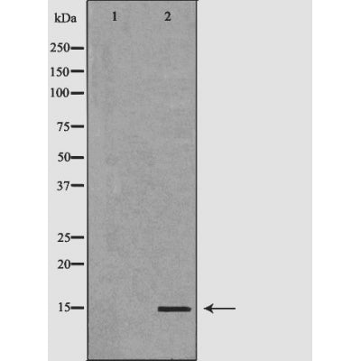 DF6035 at 1/100 staining Mouse brain tissue by IHC-P. The sample was formaldehyde fixed and a heat mediated antigen retrieval step in citrate buffer was performed. The sample was then blocked and incubated with the antibody for 1.5 hours at 22¡ãC. An HRP conjugated goat anti-rabbit antibody was used as the secondary