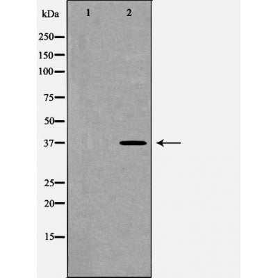 Western blot analysis of extracts of SW480, using FAS antibody. The lane on the left is treated with the antigen-specific peptide.