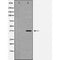 Western blot analysis of extracts of SW480, using FAS antibody. The lane on the left is treated with the antigen-specific peptide.