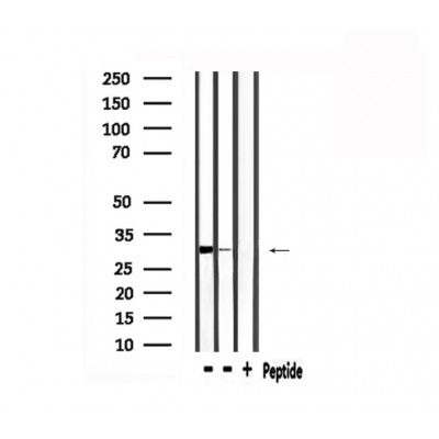 DF6038 at 1/100 staining Human lung tissue by IHC-P. The sample was formaldehyde fixed and a heat mediated antigen retrieval step in citrate buffer was performed. The sample was then blocked and incubated with the antibody for 1.5 hours at 22¡ãC. An HRP conjugated goat anti-rabbit antibody was used as the secondary