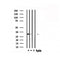 DF6038 at 1/100 staining Human lung tissue by IHC-P. The sample was formaldehyde fixed and a heat mediated antigen retrieval step in citrate buffer was performed. The sample was then blocked and incubated with the antibody for 1.5 hours at 22¡ãC. An HRP conjugated goat anti-rabbit antibody was used as the secondary