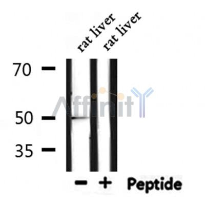 Western blot analysis of extracts from Rat brain, using GFAP Antibody. Lane 1 was treated with the blocking peptide.