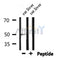Western blot analysis of extracts from Rat brain, using GFAP Antibody. Lane 1 was treated with the blocking peptide.