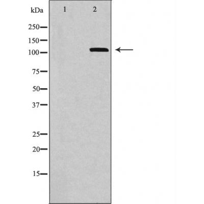 DF6042 staining Hela by IF/ICC. The sample were fixed with PFA and permeabilized in 0.1% Triton X-100,then blocked in 10% serum for 45 minutes at 25¡ãC. The primary antibody was diluted at 1/200 and incubated with the sample for 1 hour at 37¡ãC. An  Alexa Fluor 594 conjugated goat anti-rabbit IgG (H+L) Ab, diluted at 1/600, was used as the secondary antibod