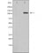 DF6042 staining Hela by IF/ICC. The sample were fixed with PFA and permeabilized in 0.1% Triton X-100,then blocked in 10% serum for 45 minutes at 25¡ãC. The primary antibody was diluted at 1/200 and incubated with the sample for 1 hour at 37¡ãC. An  Alexa Fluor 594 conjugated goat anti-rabbit IgG (H+L) Ab, diluted at 1/600, was used as the secondary antibod