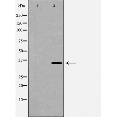 Western blot analysis of extracts of PC3 , using c-Jun antibody. The lane on the left is treated with the antigen-specific peptide.