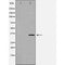 Western blot analysis of extracts of PC3 , using c-Jun antibody. The lane on the left is treated with the antigen-specific peptide.