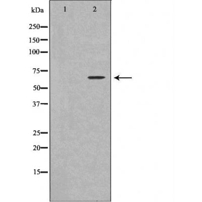 DF6052 at 1/100 staining Human spleen tissue by IHC-P. The sample was formaldehyde fixed and a heat mediated antigen retrieval step in citrate buffer was performed. The sample was then blocked and incubated with the antibody for 1.5 hours at 22¡ãC. An HRP conjugated goat anti-rabbit antibody was used as the secondary
