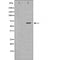 DF6052 at 1/100 staining Human spleen tissue by IHC-P. The sample was formaldehyde fixed and a heat mediated antigen retrieval step in citrate buffer was performed. The sample was then blocked and incubated with the antibody for 1.5 hours at 22¡ãC. An HRP conjugated goat anti-rabbit antibody was used as the secondary