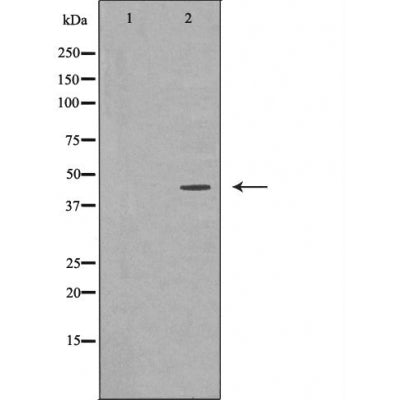 Western blot analysis of MCF7 cell lysate, using MEK2 Antibody. The lane on the left is treated with the antigen-specific peptide.