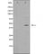 Western blot analysis of MCF7 cell lysate, using MEK2 Antibody. The lane on the left is treated with the antigen-specific peptide.