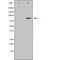DF6057 staining HepG2 by IF/ICC. The sample were fixed with PFA and permeabilized in 0.1% Triton X-100,then blocked in 10% serum for 45 minutes at 25¡ãC. The primary antibody was diluted at 1/200 and incubated with the sample for 1 hour at 37¡ãC. An  Alexa Fluor 594 conjugated goat anti-rabbit IgG (H+L) Ab, diluted at 1/600, was used as the secondary antibod