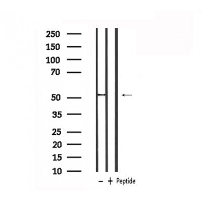 DF6059 at 1/100 staining Mouse lung tissue by IHC-P. The sample was formaldehyde fixed and a heat mediated antigen retrieval step in citrate buffer was performed. The sample was then blocked and incubated with the antibody for 1.5 hours at 22¡ãC. An HRP conjugated goat anti-rabbit antibody was used as the secondary