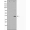DF6063 at 1/100 staining Mouse liver tissue by IHC-P. The sample was formaldehyde fixed and a heat mediated antigen retrieval step in citrate buffer was performed. The sample was then blocked and incubated with the antibody for 1.5 hours at 22¡ãC. An HRP conjugated goat anti-rabbit antibody was used as the secondary