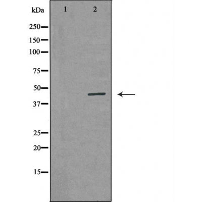 DF6066 at 1/100 staining Mouse colon tissue by IHC-P. The sample was formaldehyde fixed and a heat mediated antigen retrieval step in citrate buffer was performed. The sample was then blocked and incubated with the antibody for 1.5 hours at 22¡ãC. An HRP conjugated goat anti-rabbit antibody was used as the secondary