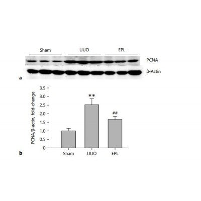 DF6067 staining Hela by IF/ICC. The sample were fixed with PFA and permeabilized in 0.1% Triton X-100,then blocked in 10% serum for 45 minutes at 25¡ãC. The primary antibody was diluted at 1/200 and incubated with the sample for 1 hour at 37¡ãC. An  Alexa Fluor 594 conjugated goat anti-rabbit IgG (H+L) Ab, diluted at 1/600, was used as the secondary antibod