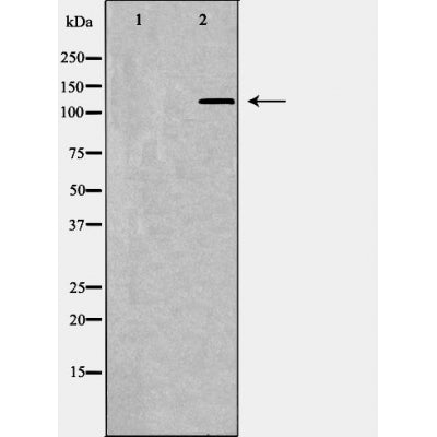 Western blot analysis of Jurkat , using PIK3CA antibody. The lane on the left is treated with the antigen-specific peptide.