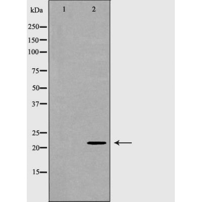 Western blot analysis of Hela whole cell lysates, using RhoA Antibody. The lane on the left is treated with the antigen-specific peptide.