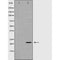 Western blot analysis of Hela whole cell lysates, using RhoA Antibody. The lane on the left is treated with the antigen-specific peptide.
