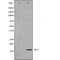 DF6077 at 1/100 staining Mouse kidney tissue by IHC-P. The sample was formaldehyde fixed and a heat mediated antigen retrieval step in citrate buffer was performed. The sample was then blocked and incubated with the antibody for 1.5 hours at 22¡ãC. An HRP conjugated goat anti-rabbit antibody was used as the secondary