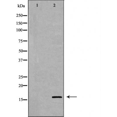 DF6077 at 1/100 staining Mouse kidney tissue by IHC-P. The sample was formaldehyde fixed and a heat mediated antigen retrieval step in citrate buffer was performed. The sample was then blocked and incubated with the antibody for 1.5 hours at 22¡ãC. An HRP conjugated goat anti-rabbit antibody was used as the secondary