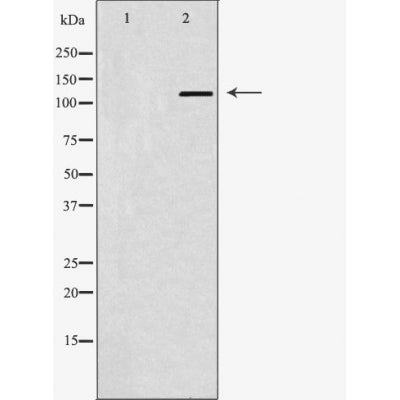 DF6083 staining  Hela cells by IF/ICC. The sample were fixed with PFA and permeabilized in 0.1% Triton X-100,then blocked in 10% serum for 45 minutes at 25¡ãC. The primary antibody was diluted at 1/200 and incubated with the sample for 1 hour at 37¡ãC. An  Alexa Fluor 594 conjugated goat anti-rabbit IgG (H+L) antibody(Cat.# S0006), diluted at 1/600, was used as secondary antibod