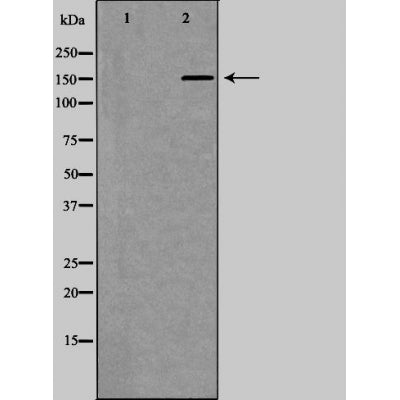 DF6084 staining MDA-MB-435 cells by IF/ICC. The sample were fixed with PFA and permeabilized in 0.1% Triton X-100,then blocked in 10% serum for 45 minutes at 25¡ãC. The primary antibody was diluted at 1/200 and incubated with the sample for 1 hour at 37¡ãC. An  Alexa Fluor 594 conjugated goat anti-rabbit IgG (H+L) antibody(Cat.# S0006), diluted at 1/600, was used as secondary antibod